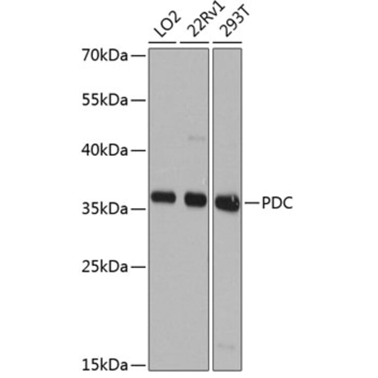 Western Blot - Anti-PHOS/PDC Antibody (A16200) - Antibodies.com