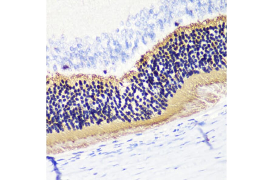 Immunohistochemistry - Anti-PHOS/PDC Antibody (A16200) - Antibodies.com