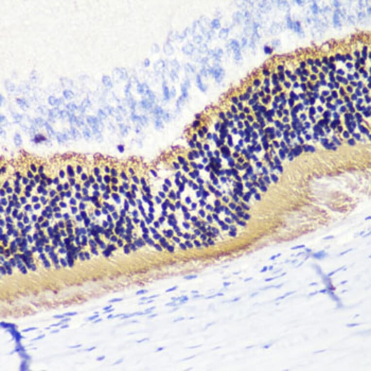 Immunohistochemistry - Anti-PHOS/PDC Antibody (A16200) - Antibodies.com