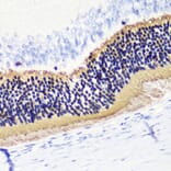 Immunohistochemistry - Anti-PHOS/PDC Antibody (A16200) - Antibodies.com