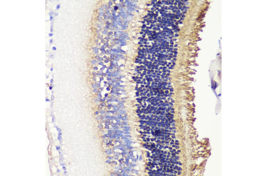 Immunohistochemistry - Anti-PHOS/PDC Antibody (A16200) - Antibodies.com