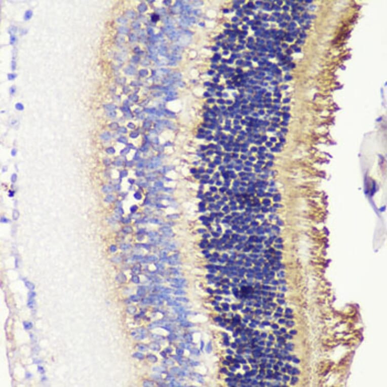 Immunohistochemistry - Anti-PHOS/PDC Antibody (A16200) - Antibodies.com