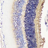 Immunohistochemistry - Anti-PHOS/PDC Antibody (A16200) - Antibodies.com