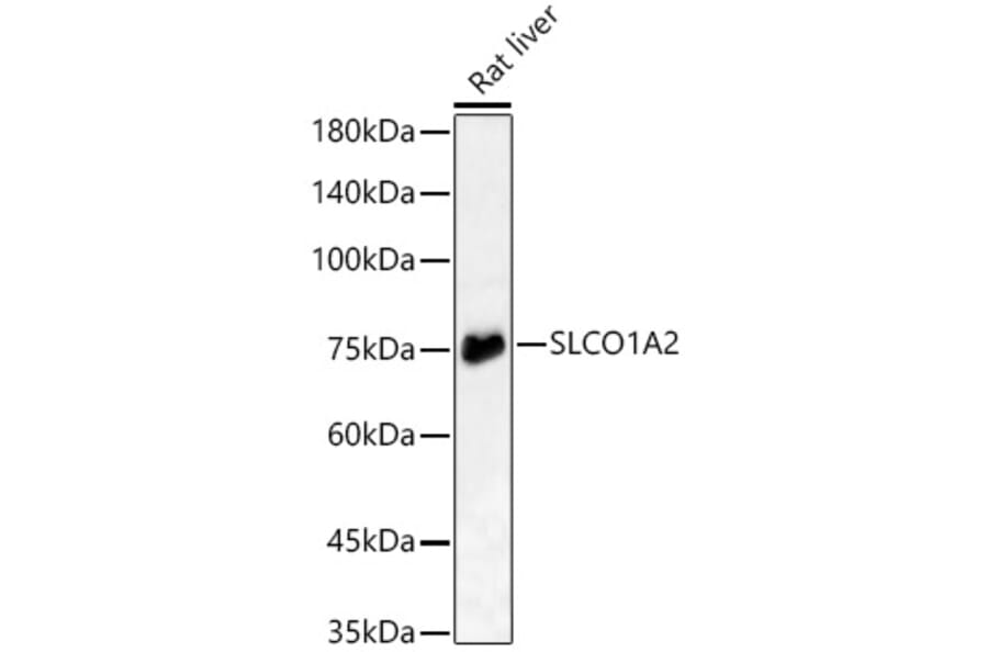 Western Blot - Anti-OATP1A2 Antibody (A16202) - Antibodies.com