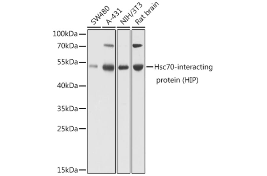 Western Blot - Anti-HSC70 Interacting Protein HIP Antibody (A16203) - Antibodies.com
