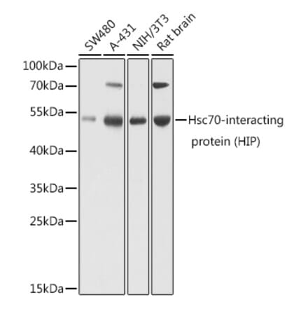 Western Blot - Anti-HSC70 Interacting Protein HIP Antibody (A16203) - Antibodies.com