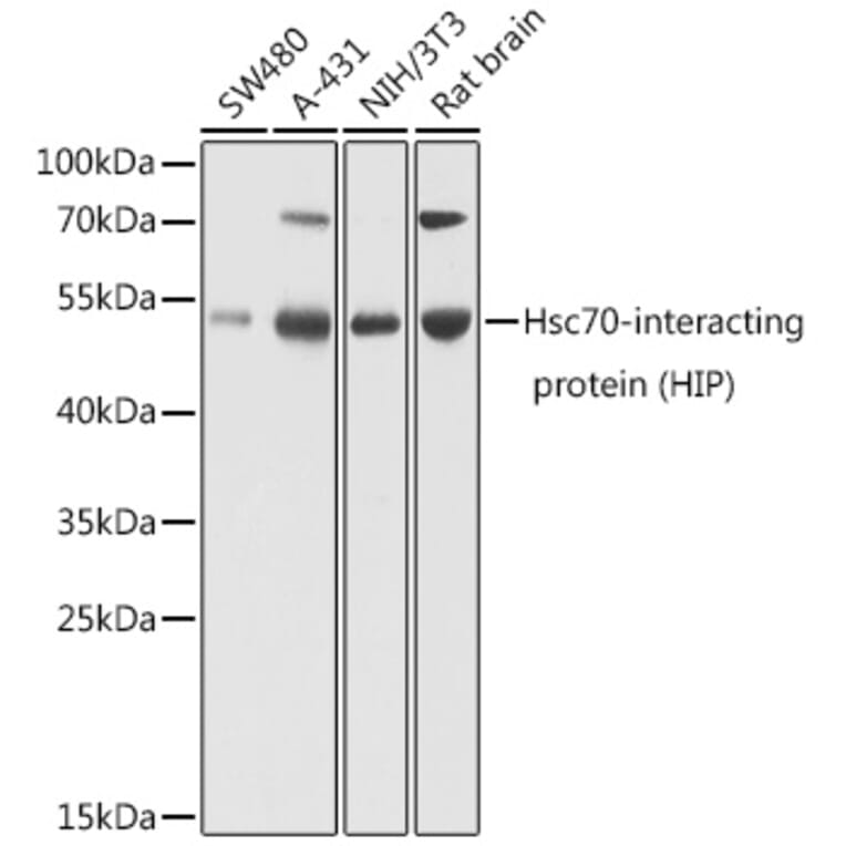 Western Blot - Anti-HSC70 Interacting Protein HIP Antibody (A16203) - Antibodies.com