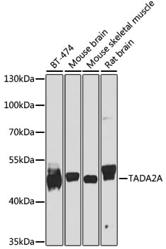 Western blot analysis of extracts of various cell lines, using Anti-TADA2A Antibody (A8457) at 1:1,000 dilution.
Secondary antibody: Goat Anti-Rabbit IgG (H+L) (HRP) (AS014) at 1:10,000 dilution.
Lysates / proteins: 25µg per lane.
Blocking buffer: 3% non-fat dry milk in TBST.
Detection: ECL Enhanced Kit (RM00021).
Exposure time: 10s.