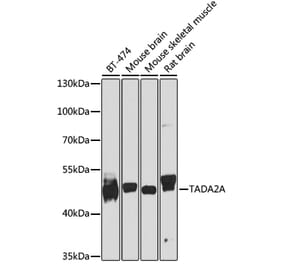 Western Blot - Anti-TADA2A Antibody (A16204) - Antibodies.com