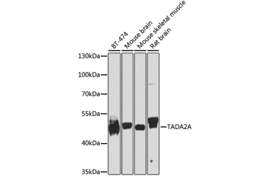 Western Blot - Anti-TADA2A Antibody (A16204) - Antibodies.com