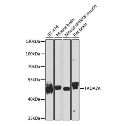 Western Blot - Anti-TADA2A Antibody (A16204) - Antibodies.com