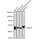 Western Blot - Anti-TADA2A Antibody (A16204) - Antibodies.com