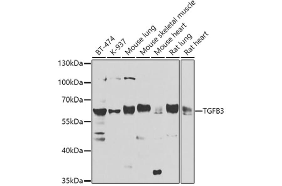 Western Blot - Anti-TGF beta 3 Antibody (A16205) - Antibodies.com