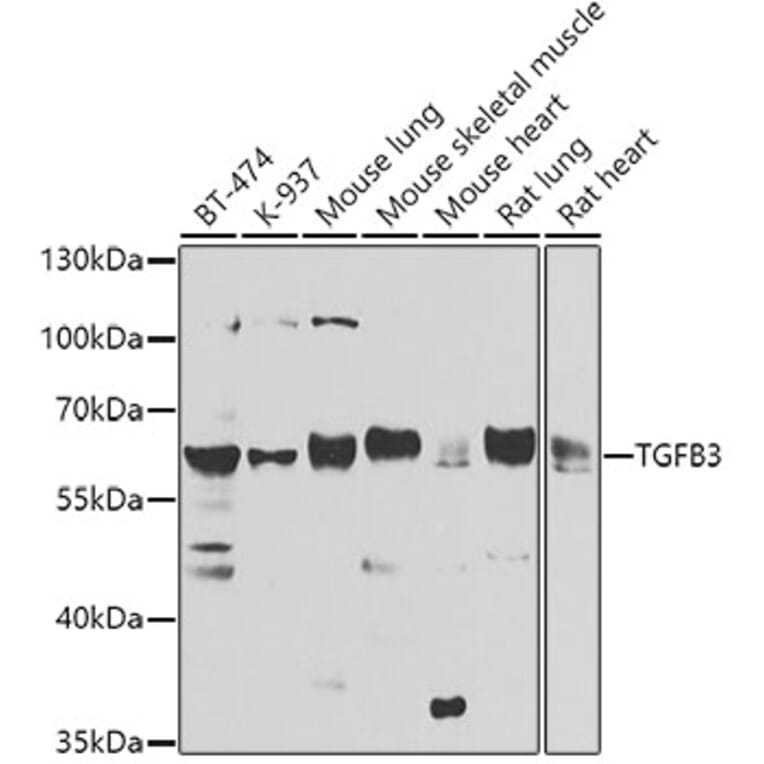 Western Blot - Anti-TGF beta 3 Antibody (A16205) - Antibodies.com