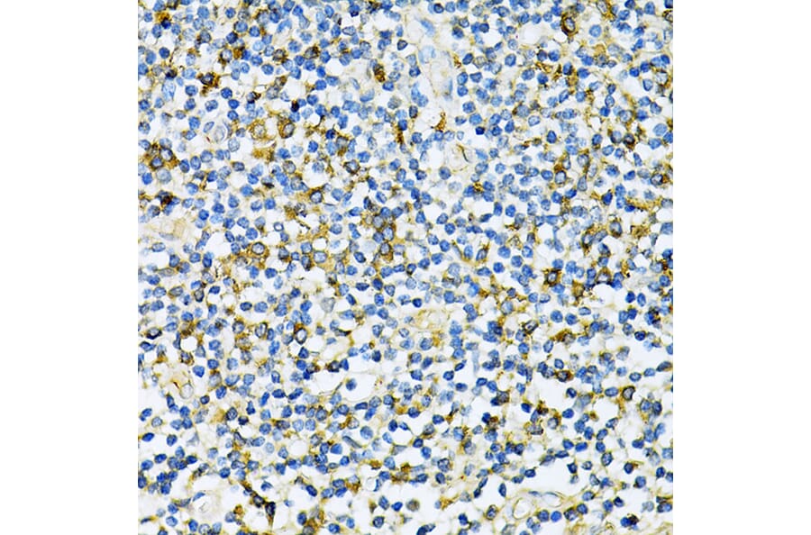 Immunohistochemistry - Anti-UVRAG Antibody (A16206) - Antibodies.com