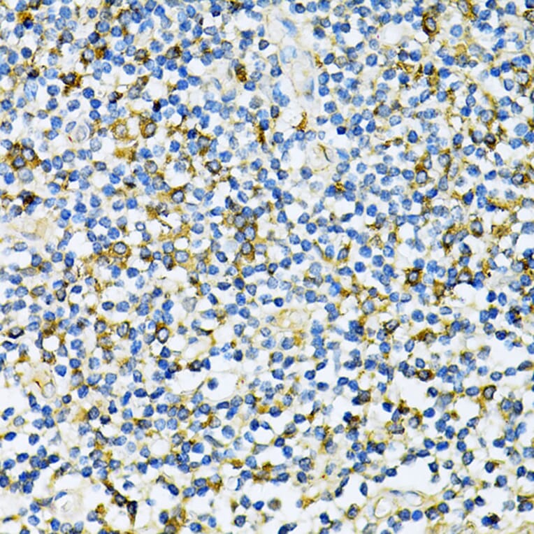 Immunohistochemistry - Anti-UVRAG Antibody (A16206) - Antibodies.com