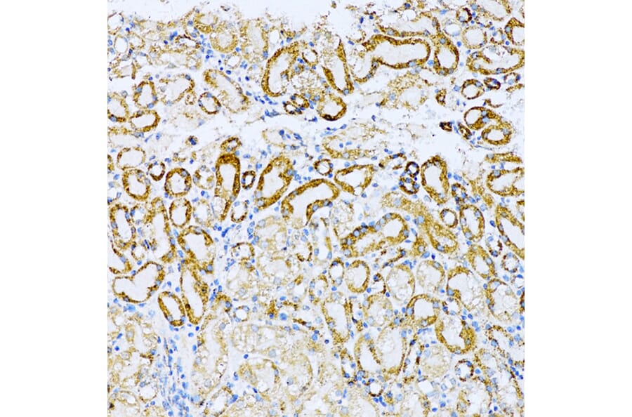 Immunohistochemistry - Anti-UVRAG Antibody (A16206) - Antibodies.com