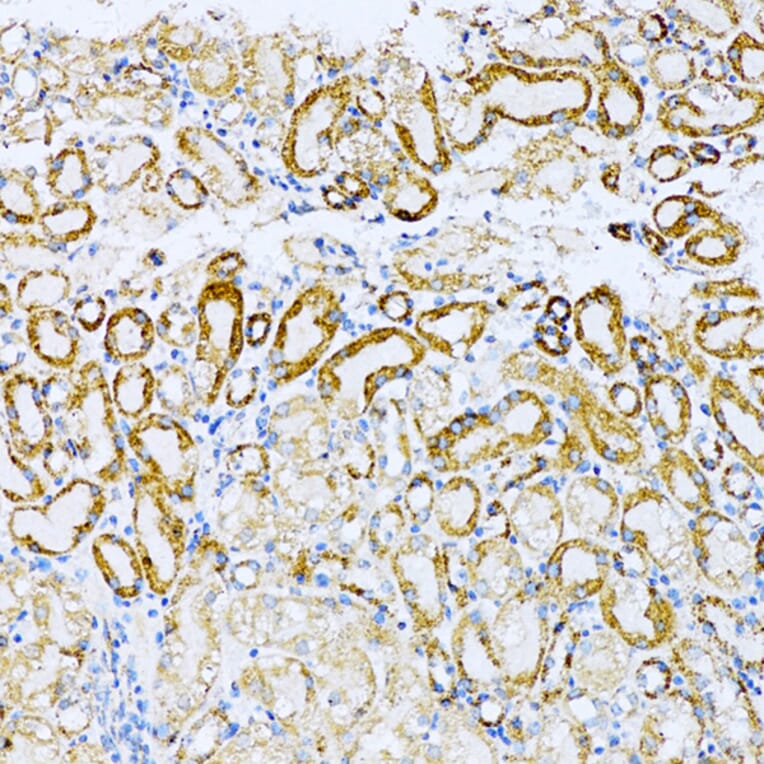 Immunohistochemistry - Anti-UVRAG Antibody (A16206) - Antibodies.com