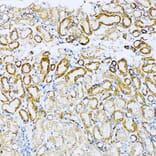 Immunohistochemistry - Anti-UVRAG Antibody (A16206) - Antibodies.com