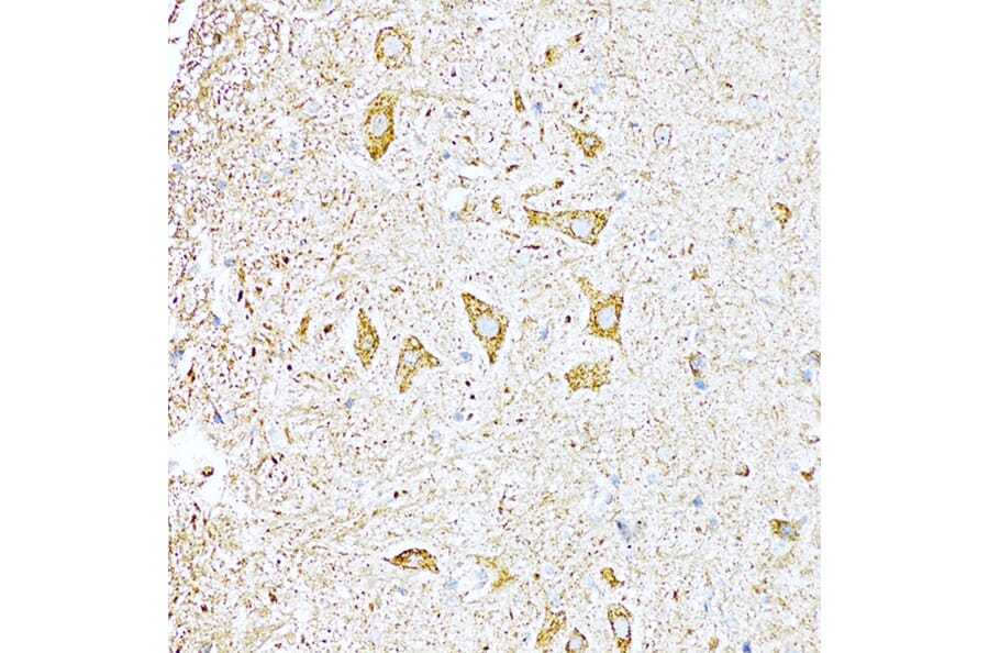 Immunohistochemistry - Anti-UVRAG Antibody (A16206) - Antibodies.com