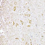 Immunohistochemistry - Anti-UVRAG Antibody (A16206) - Antibodies.com