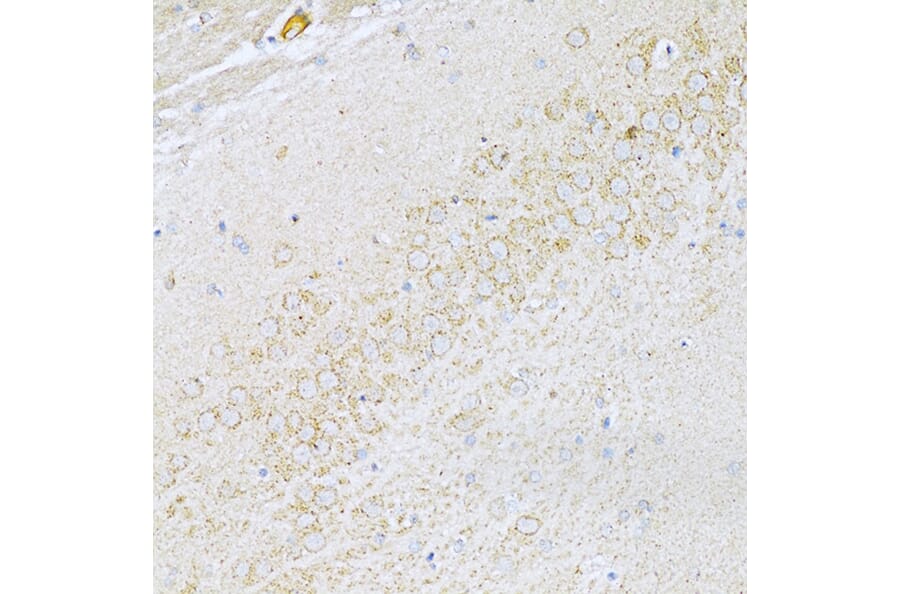 Immunohistochemistry - Anti-UVRAG Antibody (A16206) - Antibodies.com