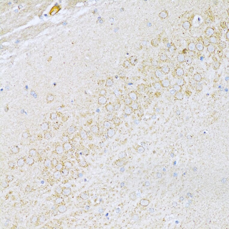 Immunohistochemistry - Anti-UVRAG Antibody (A16206) - Antibodies.com