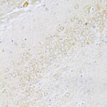 Immunohistochemistry - Anti-UVRAG Antibody (A16206) - Antibodies.com