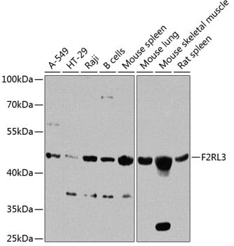 Western blot analysis of extracts of various cell lines, using Anti-F2RL3 Antibody (A8471) at 1:1,000 dilution.
Secondary antibody: Goat Anti-Rabbit IgG (H+L) (HRP) (AS014) at 1:10,000 dilution.
Lysates / proteins: 25µg per lane.
Blocking buffer: 3% non-fat dry milk in TBST.
Detection: ECL Basic Kit (RM00020).
Exposure time: 90s.