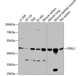 Western Blot - Anti-F2RL3 Antibody (A16208) - Antibodies.com