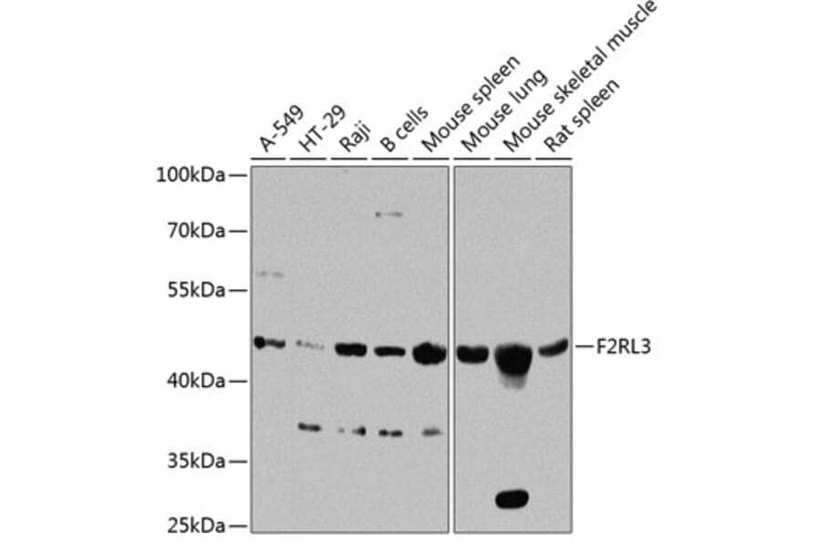Western Blot - Anti-F2RL3 Antibody (A16208) - Antibodies.com