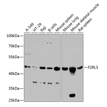 Western Blot - Anti-F2RL3 Antibody (A16208) - Antibodies.com