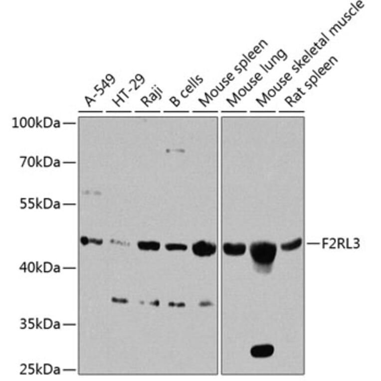 Western Blot - Anti-F2RL3 Antibody (A16208) - Antibodies.com