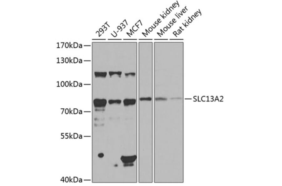 Western Blot - Anti-NaDC-1 Antibody (A16209) - Antibodies.com