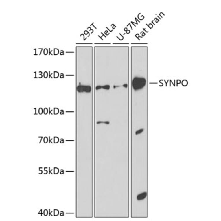Western Blot - Anti-Synaptopodin Antibody (A16211) - Antibodies.com