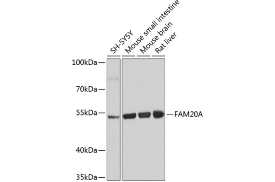Western Blot - Anti-FAM20A Antibody (A16212) - Antibodies.com