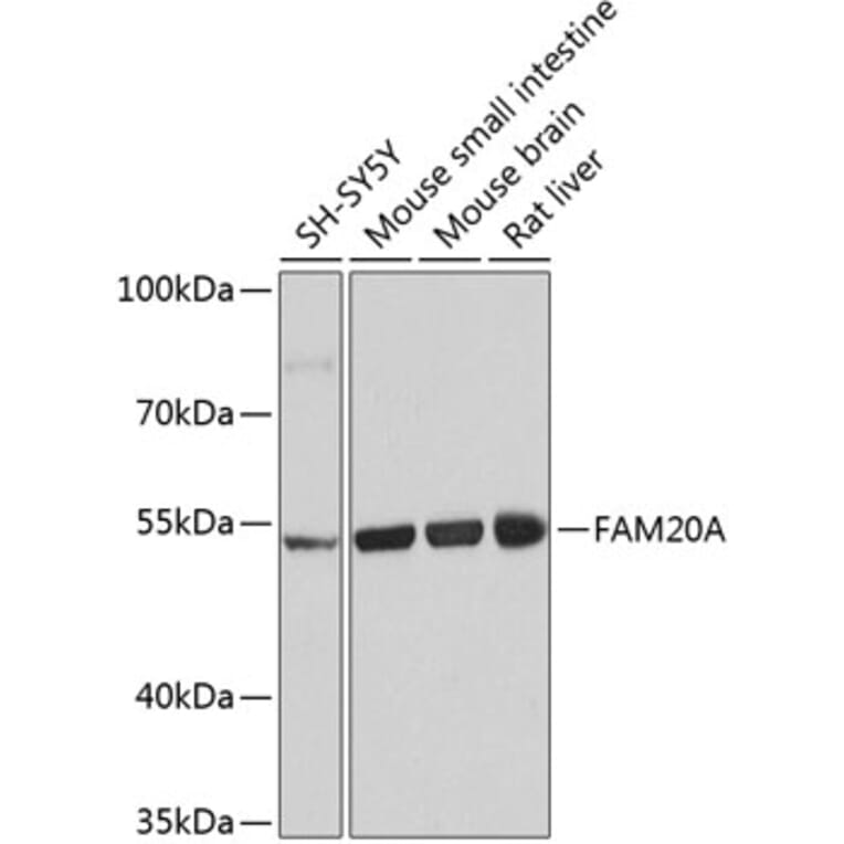 Western Blot - Anti-FAM20A Antibody (A16212) - Antibodies.com