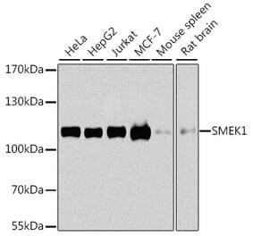 Western Blot - Anti-Smek1 Antibody (A16213) - Antibodies.com