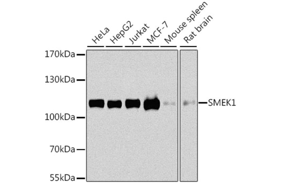 Western Blot - Anti-Smek1 Antibody (A16213) - Antibodies.com