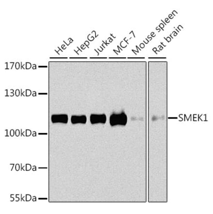 Western Blot - Anti-Smek1 Antibody (A16213) - Antibodies.com