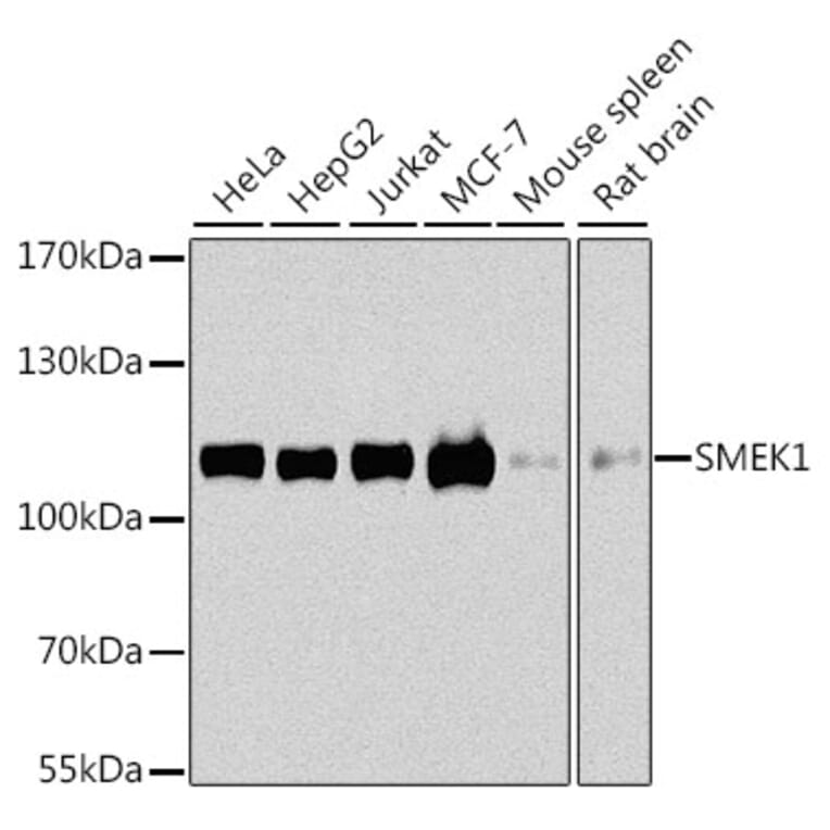 Western Blot - Anti-Smek1 Antibody (A16213) - Antibodies.com