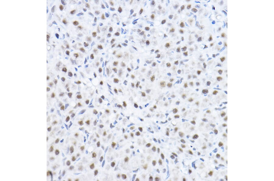 Immunohistochemistry - Anti-Smek1 Antibody (A16213) - Antibodies.com
