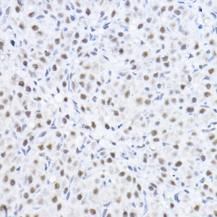 Immunohistochemistry - Anti-Smek1 Antibody (A16213) - Antibodies.com