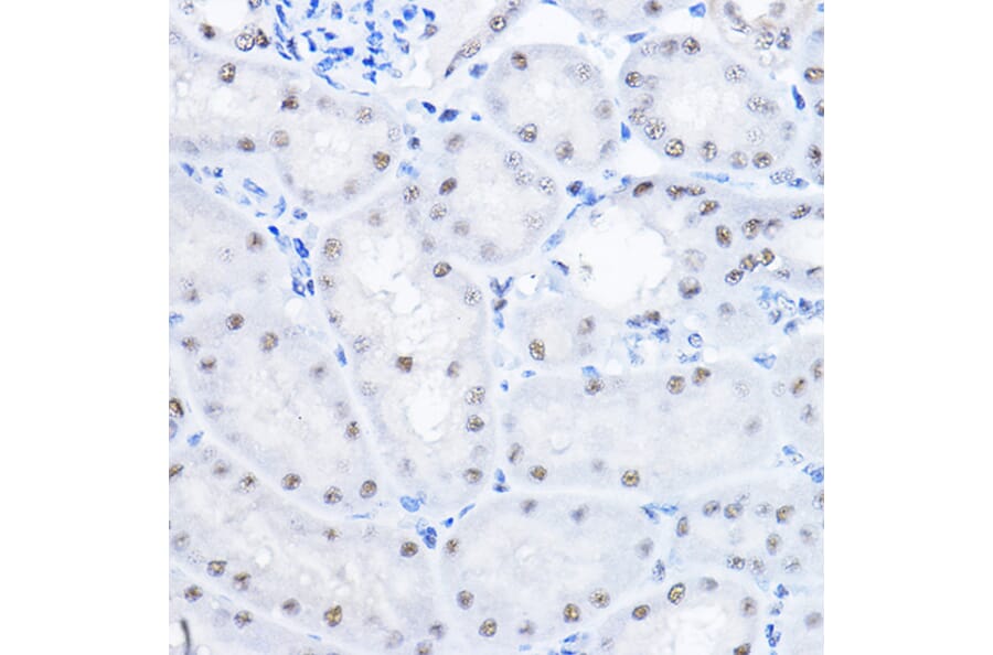 Immunohistochemistry - Anti-Smek1 Antibody (A16213) - Antibodies.com