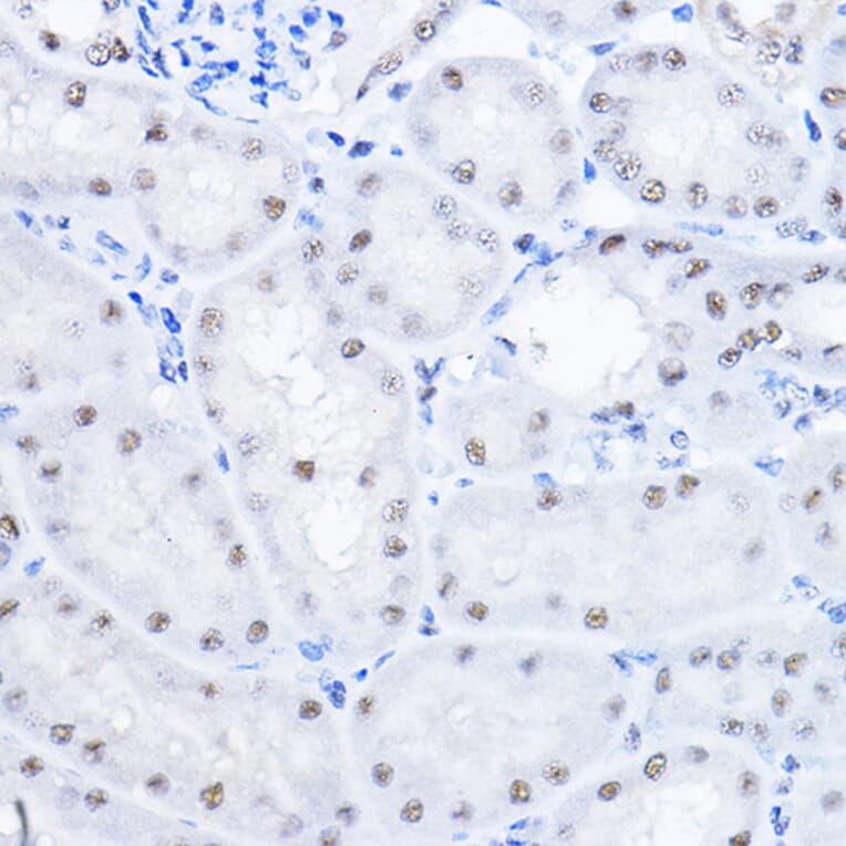 Immunohistochemistry - Anti-Smek1 Antibody (A16213) - Antibodies.com
