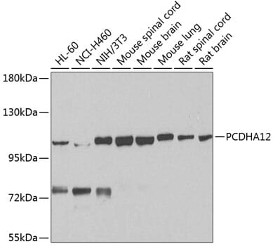Western blot analysis of extracts of various cell lines, using Anti-PCDHA12 Antibody (A8501) at 1:1,000 dilution.
Secondary antibody: Goat Anti-Rabbit IgG (H+L) (HRP) (AS014) at 1:10,000 dilution.
Lysates / proteins: 25µg per lane.
Blocking buffer: 3% non-fat dry milk in TBST.
Detection: ECL Basic Kit (RM00020).
Exposure time: 90s.