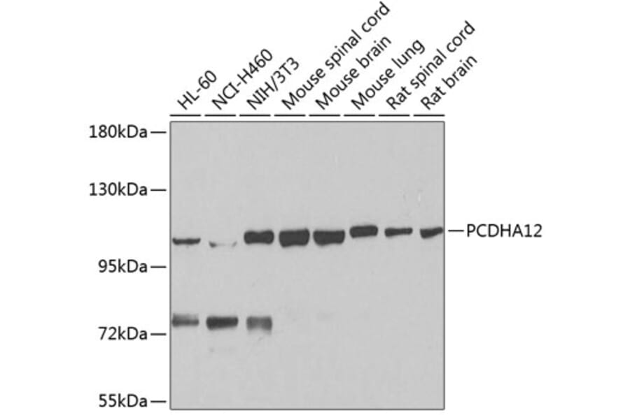 Western Blot - Anti-PCDHA12 Antibody (A16214) - Antibodies.com