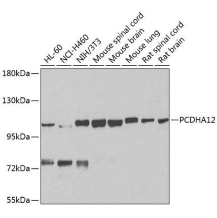 Western Blot - Anti-PCDHA12 Antibody (A16214) - Antibodies.com