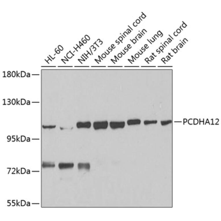 Western Blot - Anti-PCDHA12 Antibody (A16214) - Antibodies.com