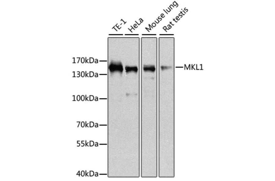 Western Blot - Anti-Mkl1/MRTFA Antibody (A16215) - Antibodies.com